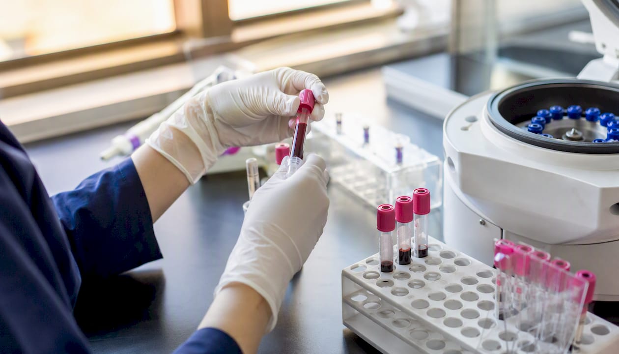 Hands preparing blood samples in fertility lab