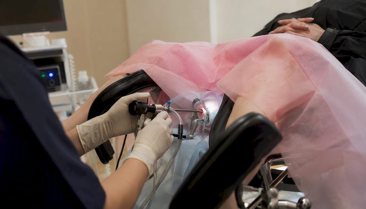 Diagnostic hysteroscopy procedure in progress